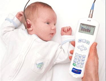 oae test results|Otoacoustic Emissions (OAEs) .